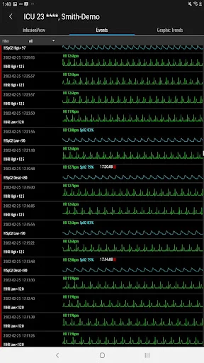I-download ang Mindray Mobile Viewer – Real-time Monitoring App - Screenshot 14
